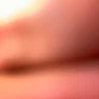 bbuurr